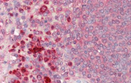AP32827AF-N - Lysozyme C