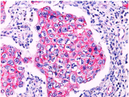 AP32836PU-T - Catenin beta-1