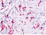 AP32836PU-T - Catenin beta-1