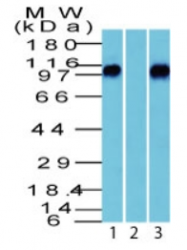 AP32836PU-T - Catenin beta-1