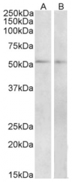 AP32928PU-N - PACAP type II Receptor / VIP Receptor