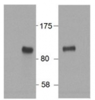 AP32955PU-N - HIC1 / ZBTB29