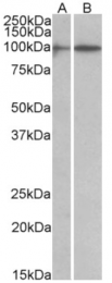 AP32955PU-N - HIC1 / ZBTB29
