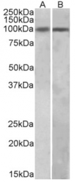 AP32956PU-N - HIC1 / ZBTB29