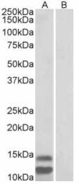 AP32957PU-N - CDKN2B / p15INK4b