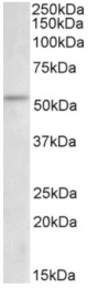 AP32963PU-N - CHK1