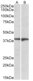 AP32969PU-N - EDG8 / S1P5