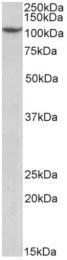 AP32970PU-N - PRPF6