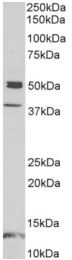 AP32971PU-N - Neuronal pentraxin-1