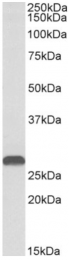 AP32974PU-N - HOXA5 / HOX1C