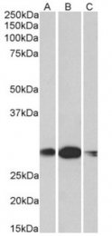 AP32974PU-N - HOXA5 / HOX1C