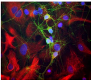 AP32983SU-N - Spectrin alpha chain (brain) / SPTAN1