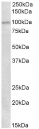AP33022PU-N - Autotaxin / ENPP2