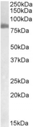 AP33115PU-N - Transglutaminase-2 (TGM2)