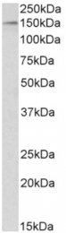 AP33144PU-N - HDAC6