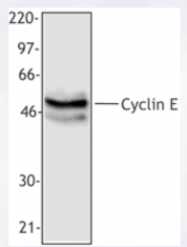 AP33174PU-N - Cyclin E1