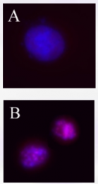 AP33179PU-S - Aurora kinase B