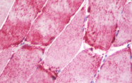 AP33224PU-N - NT5C1A