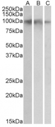 AP33228PU-N - TrkB