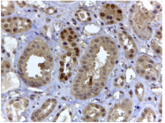 AP33233PU-N - HIF3A / HIF3 alpha