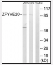 AP33276PU-N - Rabenosyn-5 / ZFYVE20