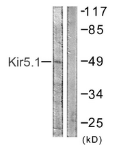 AP33279PU-N - KCNJ16