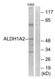 AP33281PU-N - ALDH1A2 / RALDH2