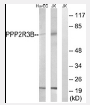 AP33283PU-N - PPP2R5D
