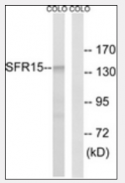 AP33284PU-N - SCAF4 / SFRS15