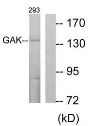AP33290PU-N - GAK