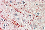 AP33296PU-N - Insulin-like growth factor II / IGF2