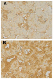 AP33335SU-S - Matrix Gla Protein