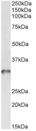 AP33349PU-N - Tropomyosin-4 (TPM4)