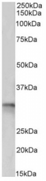 AP33349PU-N - Tropomyosin-4 (TPM4)