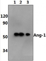 AP33394PU-N - Angiopoietin-1