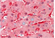 AP33394PU-N - Angiopoietin-1