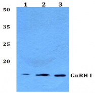 AP33395PU-N - GNRH1 / Progonadoliberin-1