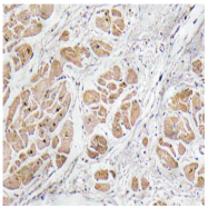 AP33395PU-N - GNRH1 / Progonadoliberin-1