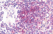 AP33400PU-N - AMP deaminase 3 / AMPD3