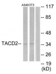 AP33403PU-N - TACSTD2