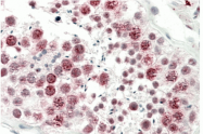 AP33419PU-N - DNAJC5G