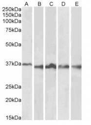 AP33481PU-N - Aurora kinase B