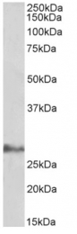 AP33483PU-N - Interleukin-17D / IL17D