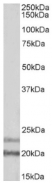 AP33484PU-N - Interleukin-17D / IL17D