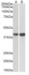 AP33495PU-N - Nuclease EXOG