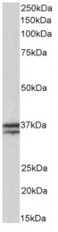 AP33501PU-N - Skeletal muscle Troponin T