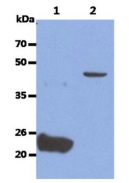 AP33507PU-S - Glypican-4 (GPC4)