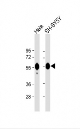 AP33519PU-N - Calreticulin