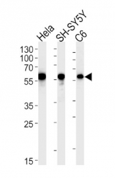 AP33519PU-N - Calreticulin