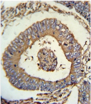AP33519PU-N - Calreticulin